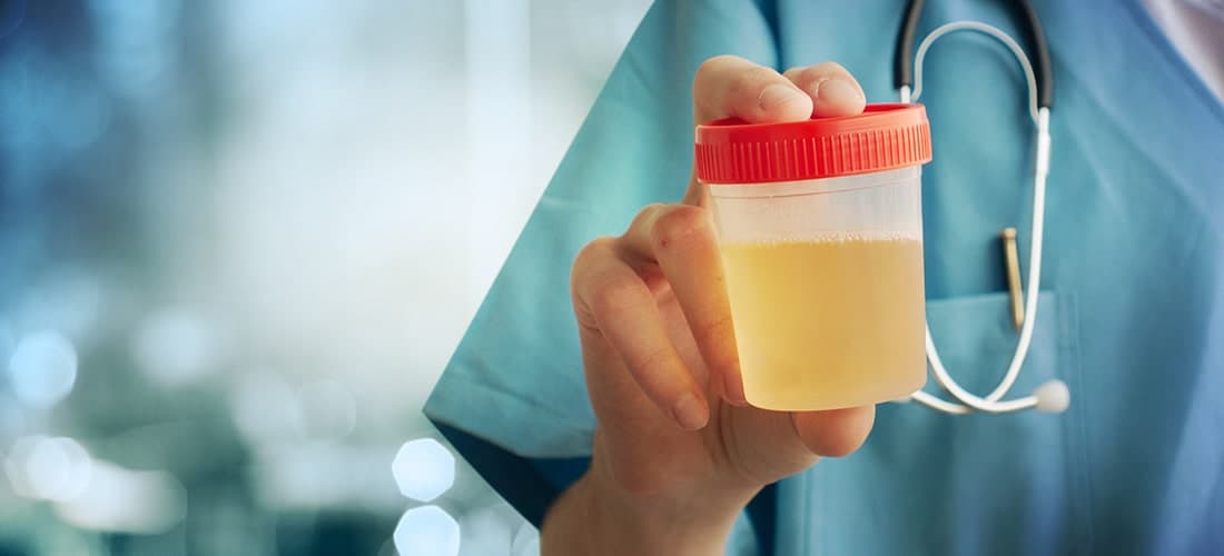Pet urine testing service